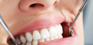 Современные способы протезирования зубов