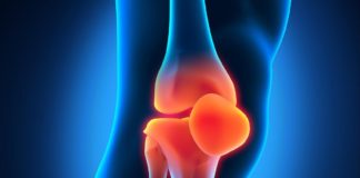 SVF терапия — инновационный метод лечения болезней суставов